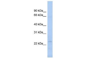 NAT9 antibody used at 1 ug/ml to detect target protein. (NAT9 Antikörper)
