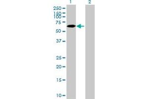 Western Blot analysis of ZNF653 expression in transfected 293T cell line by ZNF653 MaxPab polyclonal antibody.