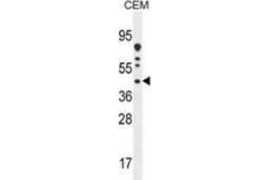 DNAJC22 Antikörper  (C-Term)