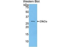 PDK2 Antikörper  (AA 155-379)