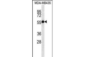 ASB4 Antikörper  (C-Term)