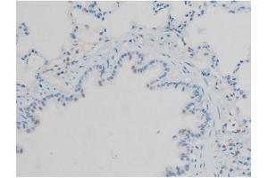 ABIN6256297 and ABIN6267410 at 1/200 staining Rat lung tissue sections by IHC-P. (Connexin 43/GJA1 Antikörper  (pSer368))