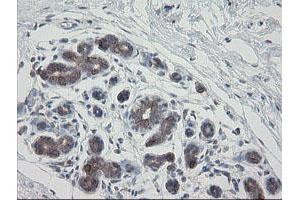 Immunohistochemical staining of paraffin-embedded Human breast tissue using anti-VBP1 mouse monoclonal antibody. (VBP1 Antikörper)