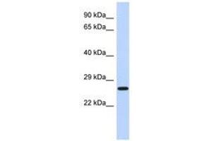 Image no. 1 for anti-EF-Hand Domain Family, Member D2 (EFHD2) (N-Term) antibody (ABIN6741472) (EFHD2 Antikörper  (N-Term))
