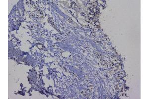 IHC analysis of NRF1 using anti-NRF1 antibody (ABIN6719347). (NRF1 Antikörper  (AA 246-503))