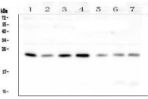 Western blot analysis of RAB11B using anti-RAB11B antibody (ABIN6719364). (RAB11B Antikörper)