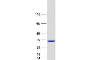 Western Blotting (WB) image for Proline Synthetase Co-Transcribed (PROSC) protein (Myc-DYKDDDDK Tag) (ABIN2729769)