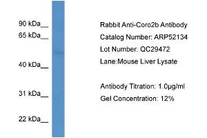 WB Suggested Anti-Coro2b  Antibody Titration: 0. (CORO2B Antikörper  (C-Term))