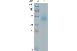 SDS-PAGE (SDS) image for Receptor Tyrosine-Protein Kinase ErbB-3 (ERBB3) (AA 544-643) protein (mFc Tag) (ABIN7538508)