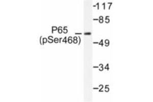 Image no. 1 for anti-Nuclear Factor-kB p65 (NFkBP65) (pSer468) antibody (ABIN318083) (NF-kB p65 Antikörper  (pSer468))