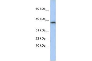 WB Suggested Anti-GLYAT Antibody Titration:  0. (GLYAT Antikörper  (N-Term))
