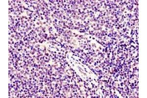 Immunohistochemistry of paraffin-embedded human lymph node tissue using ABIN7171071 at dilution of 1:100