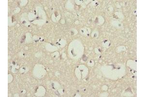 Immunohistochemistry of paraffin-embedded human brain tissue using ABIN7162207 at dilution of 1:100 (OMG Antikörper  (AA 190-420))