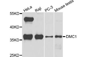 Western blot analysis of extracts of various cell lines, using DMC1 antibody (ABIN5972548) at 1/1000 dilution. (DMC1 Antikörper)