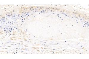 Detection of MYH9 in Human Placenta Tissue using Polyclonal Antibody to Myosin Heavy Chain 9, Non Muscle (MYH9) (Myosin 9 Antikörper  (AA 1740-1960))