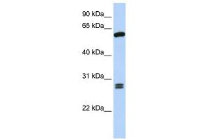 ACD antibody used at 1 ug/ml to detect target protein. (ACD Antikörper)