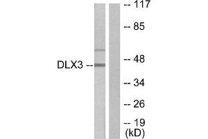 Western Blotting (WB) image for anti-Distal-Less Homeobox 3 (DLX3) (Internal Region) antibody (ABIN1848996) (DLX3 Antikörper  (Internal Region))