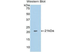 Western Blotting (WB) image for anti-Actin Related Protein 2/3 Complex, Subunit 4, 20kDa (ARPC4) (AA 3-163) antibody (ABIN1858080)