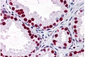 Human Prostate: Formalin-Fixed, Paraffin-Embedded (FFPE) (SMAD6 Antikörper  (AA 285-385))