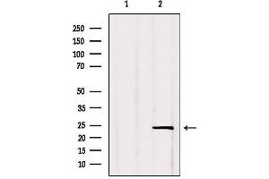 Western blot analysis of extracts from Rat lung, using RGS2 Antibody. (RGS2 Antikörper  (Internal Region))