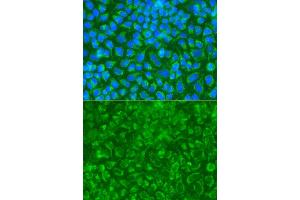 Immunofluorescence analysis of A549 cell using STRN antibody. (Striatin Antikörper)
