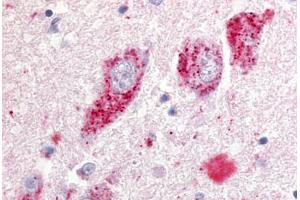 Human Basal Nucleus of Meynert (formalin-fixed, paraffin-embedded) stained with GPR20 antibody ABIN213331 at 10 ug/ml followed by biotinylated goat anti-rabbit IgG secondary antibody ABIN481713, alkaline phosphatase-streptavidin and chromogen. (GPR20 Antikörper  (N-Term))