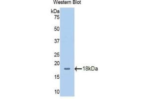 Detection of Recombinant SLC3A2, Human using Polyclonal Antibody to Solute Carrier Family 3, Member 2 (SLC3A2) (SLC3A2 Antikörper  (AA 213-349))