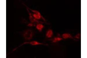 ABIN6275522 staining  Hela cells by IF/ICC. (Septin 2 Antikörper  (Internal Region))