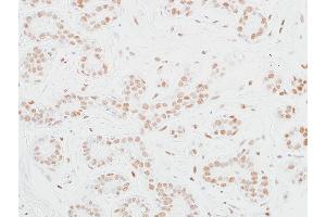 Immunohistochemistry (IHC) image for anti-Mediator Complex Subunit 12 (MED12) (AA 2127-2177) antibody (ABIN7453977) (Rekombinanter MED12 Antikörper  (AA 2127-2177))