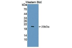 Western Blotting (WB) image for anti-Leukocyte Cell-Derived Chemotaxin 2 (LECT2) (AA 1-151) antibody (ABIN1868950)