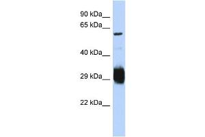 Host:  Rabbit  Target Name:  SETMAR  Sample Type:  Jurkat Whole Cell lysates  Antibody Dilution:  1.