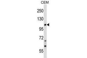 TRPC7 Antibody (C-term) western blot analysis in CEM cell line lysates (35 µg/lane). (TRPC7 Antikörper  (C-Term))