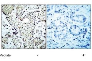 Image no. 1 for anti-Mitogen-Activated Protein Kinase Kinase 6 (MAP2K6) (AA 205-209) antibody (ABIN197355) (MAP2K6 Antikörper  (AA 205-209))