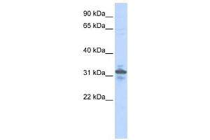 Western Blotting (WB) image for anti-Ribose 5-Phosphate Isomerase A (RPIA) antibody (ABIN2459906) (Ribose 5-Phosphate Isomerase A (RPIA) Antikörper)