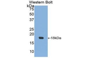 Western Blotting (WB) image for anti-Insulin-Like Growth Factor Binding Protein 3 (IGFBP3) antibody (ABIN1172095) (IGFBP3 Antikörper)