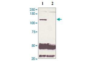 5 mg of the whole cell lysate derived from conditioned LNCaP were immunoprecipitated by 4 ug of Phospho-AR S210 polyclonal antibody (Cat # PAB12654, lane 1) or pre adsorbed by immunization peptide (lane 2) followed by AR polyclonal antibody  at 1 : 500. (Androgen Receptor Antikörper  (N-Term))