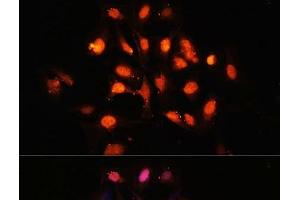 Immunofluorescence analysis of U-2 OS cells using PHLPP1 Polyclonal Antibody at dilution of 1:100 (40x lens). (PHLPP1 Antikörper)