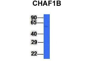 Western Blotting (WB) image for anti-Chromatin Assembly Factor 1, Subunit B (p60) (CHAF1B) (N-Term) antibody (ABIN2782376)
