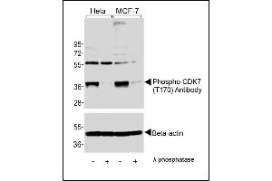Western blot analysis of extracts from Hela and MCF-7 cells, untreated or lamda phosphatase-treated, using Phospho-CDK7 Antibody (upper) or Beta-actin (lower). (CDK7 Antikörper  (pThr170))