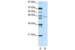 WB Suggested Anti-TRIM14 AntibodyTitration: 2. (TRIM14 Antikörper  (N-Term))