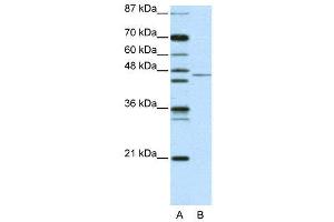 WB Suggested Anti-TRIM14 AntibodyTitration: 2. (TRIM14 Antikörper  (N-Term))