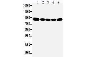 Anti-OSBP1 antibody, Western blotting Lane 1: Rat Kidney Tissue Lysate Lane 2: Rat Spleen Tissue Lysate Lane 3: Rat Lung Tissue Lysate Lane 4: HELA Cell Lysate Lane 5: A549 Cell Lysate (OSBP Antikörper  (Middle Region))