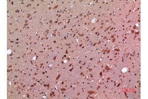 Immunohistochemistry (IHC) image for anti-Growth Differentiation Factor 5 (GDF5) (Internal Region) antibody (ABIN3187821)