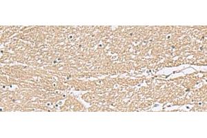 Immunohistochemistry of paraffin-embedded Human brain tissue using KCTD7 Polyclonal Antibody at dilution of 1:55(x200) (KCTD7 Antikörper)