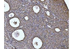 IHC analysis of COX5B using anti-COX5B antibody (ABIN7598975). (COX5B Antikörper  (AA 1-129))