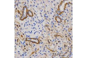 Immunohistochemistry of paraffin-embedded rat kidney using PIBF1 Antibody. (PIBF1 Antikörper)