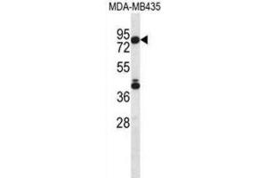 Western Blotting (WB) image for anti-Sphingosine-1-Phosphate Lyase 1 (SGPL1) antibody (ABIN2996917)