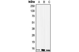 Western blot analysis of WIT1 expression in A549 (A), Raw264. (WIT1 Antikörper  (Center))