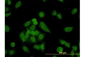 Immunofluorescence of monoclonal antibody to CNAP1 on HeLa cell. (NCAPD2 Antikörper  (AA 1240-1339))