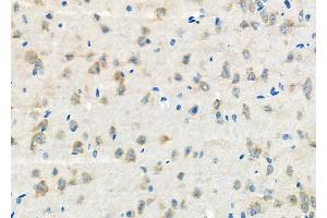 ABIN6265813 and ABIN6272621 at 1/100 staining Rat brain tissue by IHC-P.